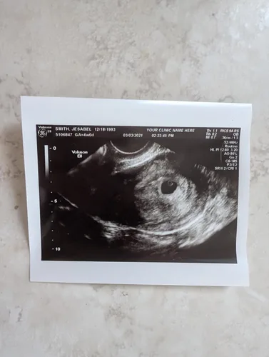 Miniatura 3 de Broma de ultrasonido falso personalizado 2D, foto única SOLO, SIN género