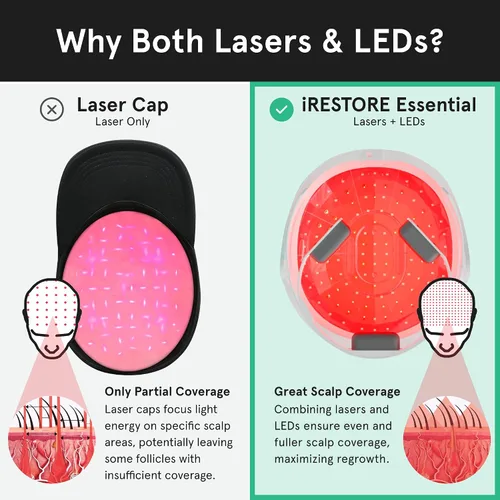 Miniatura 6 de iRestore Sistema de crecimiento del cabello con láser esencial: tratamientos de pérdida de cabello aprobados por la FDA para hombres y mujeres