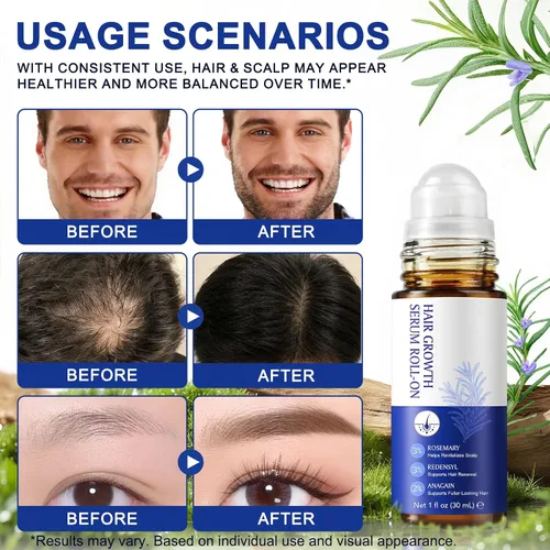 Miniatura 5 de Suero para el crecimiento del cabello, 1.0 fl oz de aceite para el crecimiento del cabello con 3% de romero, 3% de redensyl, 2% de nuevo, suero
