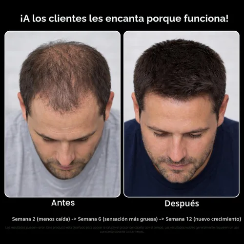 Miniatura 4 de DHT Bloqueador para hombres con biotina 10000mcg por porción, extracto de palma enana americana y MSM - Apoya el crecimiento normal del cabello