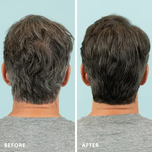 Miniatura 5 de Color de cabello y barba para mezclar grises, paquete de 2 unidades, marrón oscuro, sin amoníaco, kit completo de tinte para barba y cabello