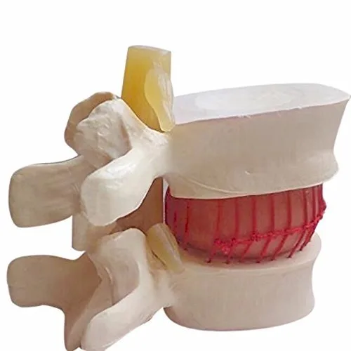 Miniatura 5 de DENTAL Color blanco oral 1:1.5 vértebras lumbares humanas anatómicas degenerativas lumbares modelo de columna vertebral humana US Stock