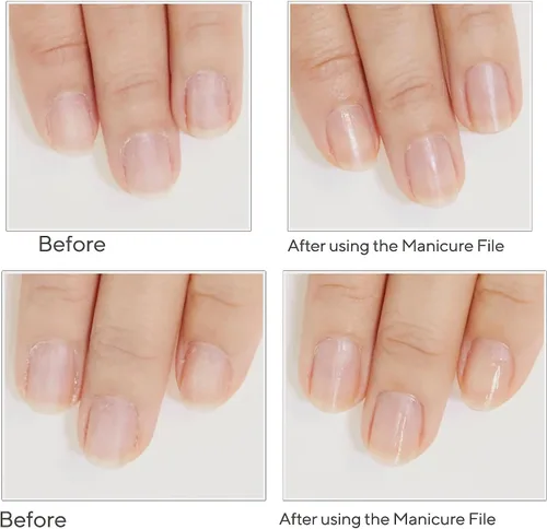 Miniatura 4 de Juego de 3 limas de uñas de vidrio resistentes profesionales con kit de estuche, herramientas reutilizables de manicura y pedicura de uñas