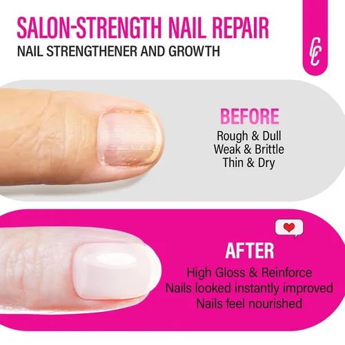 Miniatura 6 de CHUCHU Fortalecedor de uñas y reparación para mujeres: endurecedor extra fuerte blanco lechoso y tratamiento de crecimiento para pelar uñas finas