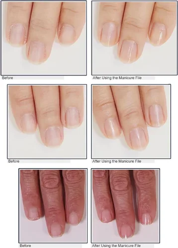 Miniatura 5 de Juego de 3 limas de uñas de vidrio resistentes profesionales con kit de estuche, herramientas reutilizables de manicura y pedicura de uñas