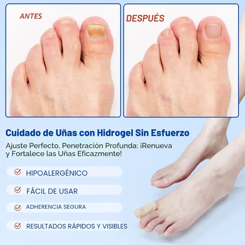 Miniatura 5 de Parches de uñas: 21 parches de reparación extra fuertes para uñas de los pies y uñas dañadas, cuidado de uñas durante la noche de 8 horas