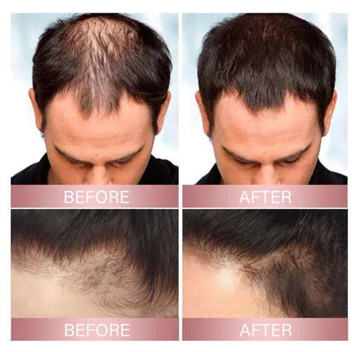 Miniatura 6 de 2 unidades de espray de agua de arroz para el crecimiento del cabello fino, aceite sin perfume para todo tipo de cabello, pulverización natural