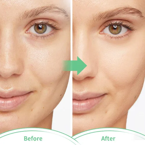 Miniatura 8 de Máscaras faciales frías, máscara facial de hielo, compresa fría y caliente, ojeras, hinchazón, migrañas y dolor de cabeza, enfriamiento