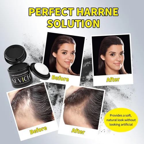 Miniatura 6 de Polvo para Línea de Cabello Sevich 2.0, Oculta Instantáneamente la Pérdida de Cabello, Polvo para Toque de Raíces, Sombra de Cabello para Mujeres