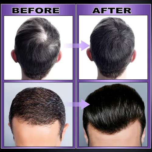 Miniatura 5 de GIFBEA Spray orgánico de suero para el crecimiento del cabello con agua de arroz negro, 5 onzas líquidas, aroma de romero, para todo
