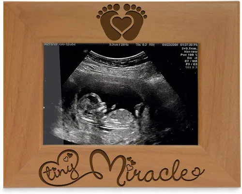 KATE POSH - Marco de fotos de madera natural grabado Tiny Miracle para bebé, nuevo papá y mamá, regalo de padres, ultrasonido, ecografía, anuncio de