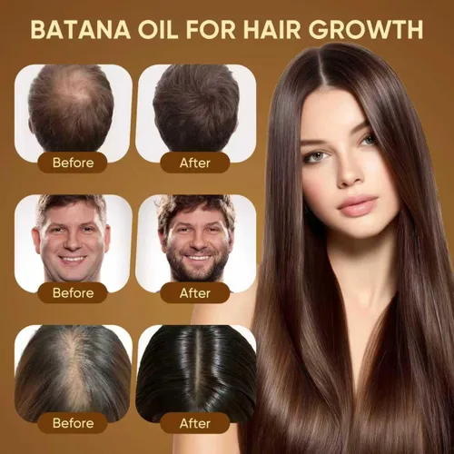 Miniatura 5 de Aceite de batana para el crecimiento del cabello, 100% puro y natural, reduce la pérdida de cabello y desintoxica tu cuero cabelludo, nutre el cuero