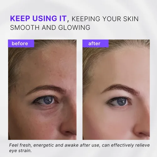 Miniatura 5 de Rodillo de ojos, masajeador facial con rodillo – Reduce la hinchazón, ojeras, terapia de enfriamiento para ojos cansados (con aplicador)