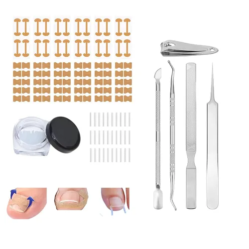 Juego de corrector de uñas encarnadas con parche de corrección de uñas curvas, kit de eliminación de uñas mejorado, herramientas de pedicura para
