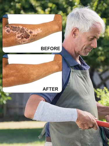 Miniatura 2 de Janmercy 9 pares de protectores de brazo para piel fina y moretones protectores de brazos para ancianos para trabajo de jardinero