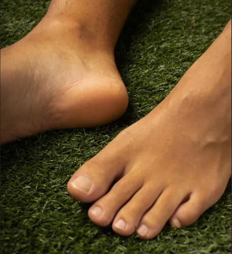 Miniatura 4 de Paquete de 2 Phoenix Foot Peel para hombre, extra grande, extra fuerte, canela, tratamiento exfoliante para pies secos, removedor de callos, sin