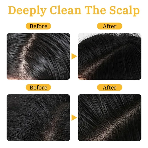 Miniatura 5 de Gray Hair Reverse - Barra de champú unisex, 2 piezas de jabón negro para limpieza profunda, jabón para oscurecer el cabello para hombres y mujeres