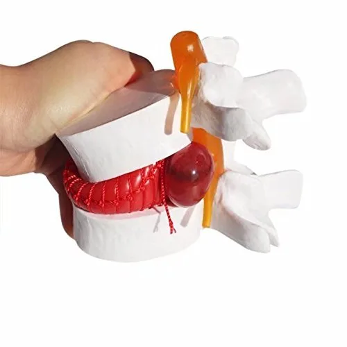 Miniatura 4 de DENTAL Color blanco oral 1:1.5 vértebras lumbares humanas anatómicas degenerativas lumbares modelo de columna vertebral humana US Stock
