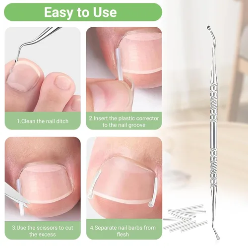 Miniatura 5 de Juego de corrector de uñas encarnadas con tiras correctoras, kit de herramientas profesionales para uñas de los pies, incluye tiras transpirables