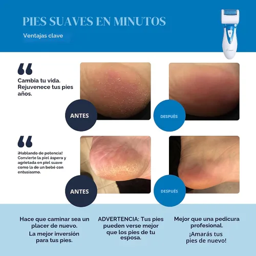 Miniatura 2 de Removedor de callos eléctrico recargable CR900 por propia armonía (probado más potente) mejores herramientas de pedicura con 2 rodillos, profesional