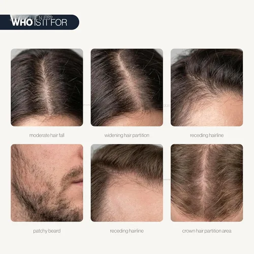 Miniatura 3 de Be Bodywise Advanced Hair Density Roll-On Serum 1.7 fl oz 5% Saw Palmetto, 3% romero, 1% herbasoma de cafeína y 3% fenogreco Suero para el cuero