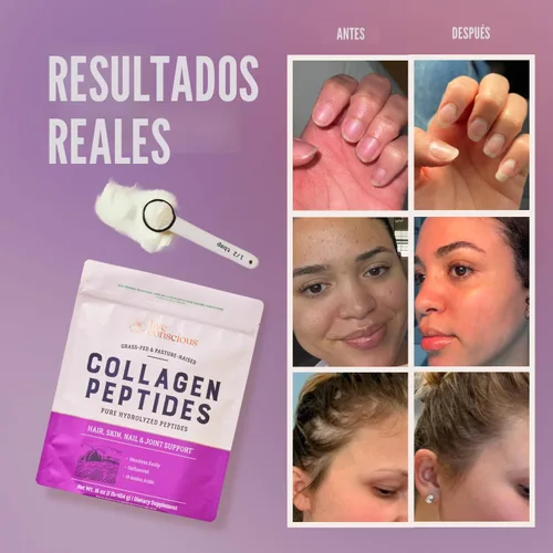 Miniatura 2 de Live Conscious Polvo de Péptidos de Colágeno – Polvo de Colágeno Hidrolizado de Origen Natural – Apoyo para el Cabello, la Piel, las Uñas