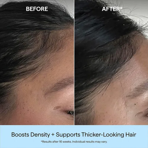 Miniatura 4 de Briogeo Destinado a la densidad de cafeína + suero de densidad de péptidos de biotina Aumenta el grosor y el volumen del cabello para cabello fino