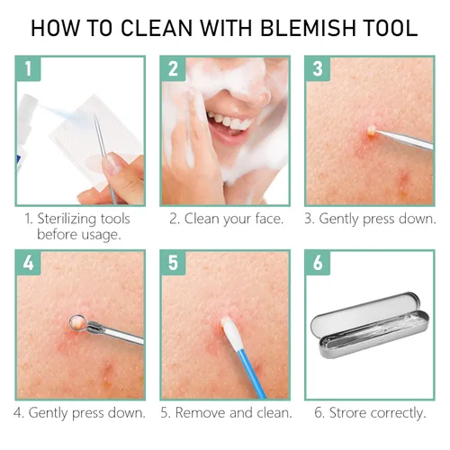 Miniatura 4 de Dr.Pedi Kit de herramientas para eliminar puntos negros, para eliminar espinillas, para acné, extractor de espinillas, aguja facial, clip