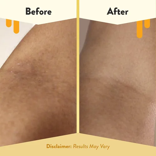Miniatura 4 de ECZEMA HONEY Baño de burbujas cómodo de avena sin fragancia, gel de baño y baño para piel sensible, productos de baño hidratantes, baño de burbujas