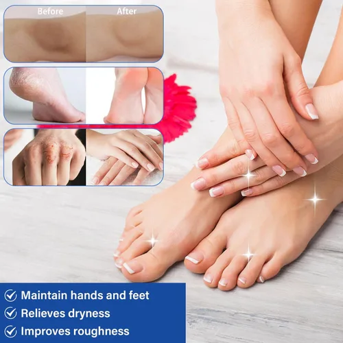 Miniatura 4 de Crema de urea 60 por ciento para pies de máxima fuerza, crema para pies de urea con ácido salicílico al 2%, loción para pies, removedor de callos