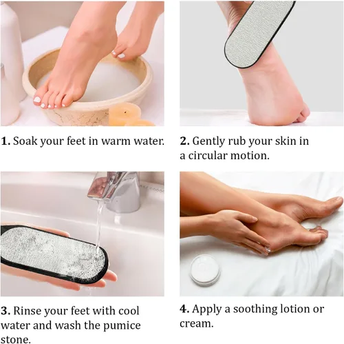 Miniatura 4 de Limpiador de pies de piedra pómez – Lima de pedicura con mango para piel seca y muerta – Removedor de callos para pies – Raspador de pies – Cepillo
