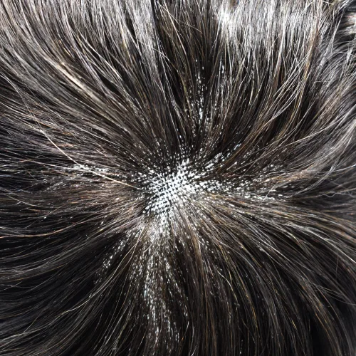 Miniatura 4 de Pieza de pelo Toupee para hombres Sistema de cabello real Sistema de encaje francés para hombre Toupee Sistema de reemplazo de pelo Protesis Capilar