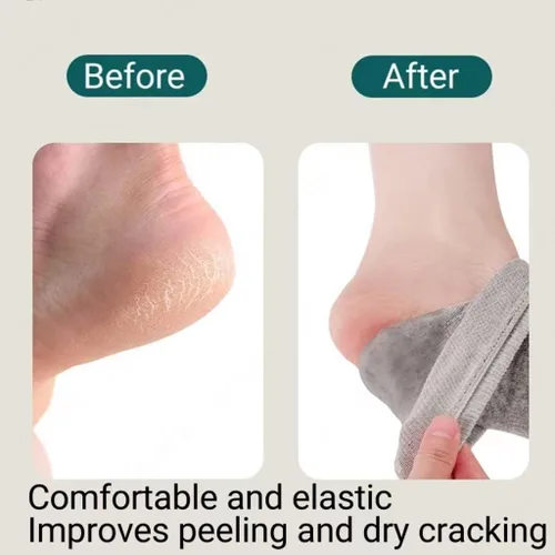 Miniatura 5 de 8 pares de calcetines hidratantes sin dedos, calcetines para dormir para mujeres y hombres, calcetines de talón de gel agrietados, reparación