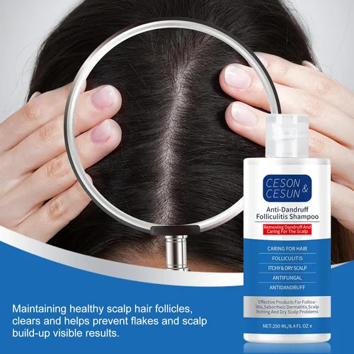 Miniatura 11 de Ceson&Cesun Champú 2 en 1 antifúngico/anticaspa para foliculitis, psoriasis del cuero cabelludo y dermatitis seborreica, alivio de la picazón
