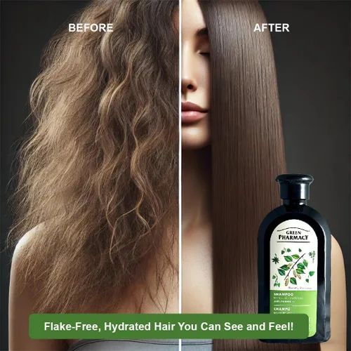 Miniatura 3 de Champú anticaspa de brotes de abedul y aceite de ricino 11.83 onzas líquidas Fortalece el cabello, hidrata y combate la caspa. Ingredientes