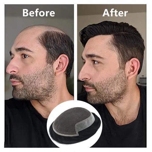 Miniatura 26 de Sistema de repuesto de cabello humano europeo con encaje frontal suizo para hombre, tupé para hombre, pieza de cabello, nudo blanqueado, línea #17