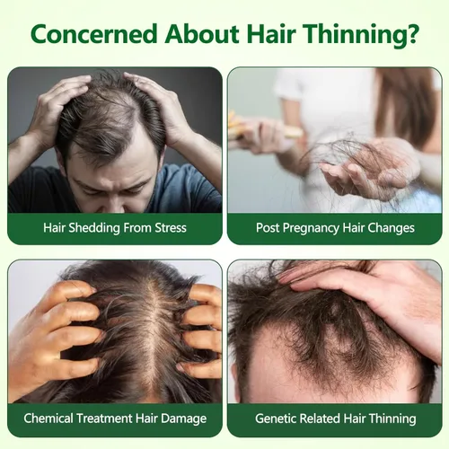 Miniatura 4 de Suero roll-on para el crecimiento del cabello, ayuda a reducir la caída del cabello y promueve un cabello más grueso y de aspecto más completo