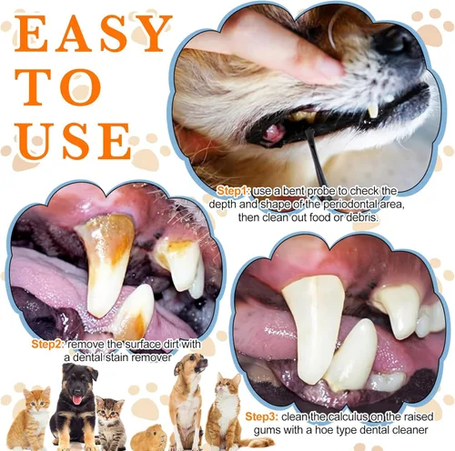 Miniatura 3 de Hotop 3 piezas de raspador dental y raspador de dientes de acero inoxidable de doble cabeza herramienta de eliminación de tarter raspador de dientes