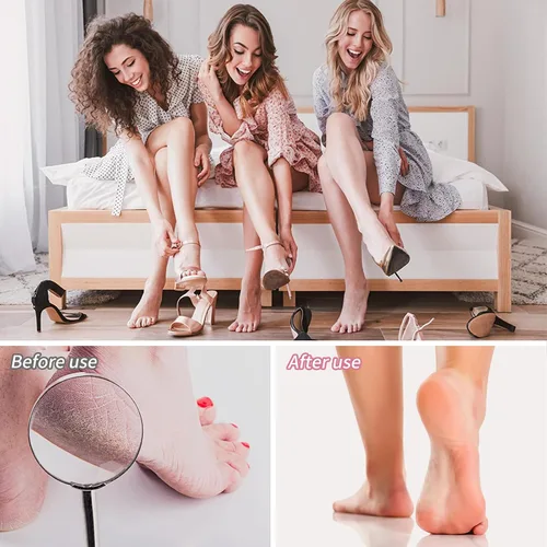 Miniatura 6 de Topmeet Removedor de callos de pies, lima profesional de acero inoxidable para piel muerta, callos y piel dura, diseño ergonómico para pies suaves
