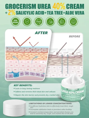 Miniatura 3 de Grocerism 2 paquetes de Crema de Urea 40% más 2% de ácido salicílico 5.30 oz Crema para pies de máxima potencia con ácido hialurónico, árbol