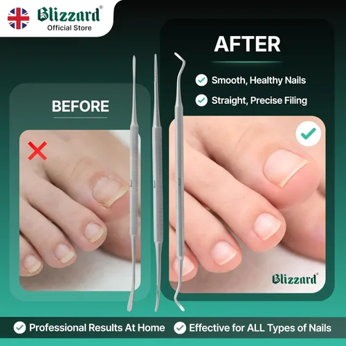 Miniatura 5 de Blizzard Juego de pedicura de lima negra de alta calidad, kit de 3 piezas de uñas encarnadas, limpiador de uñas de doble cara, lima de uñas