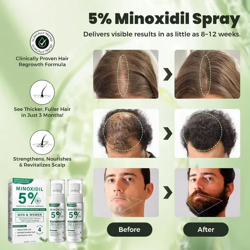 Miniatura 3 de Spray para el crecimiento del cabello de minoxidil al 5% para hombres y mujeres con aroma a romero, paquete de 2 unidades de 2.1 onzas líquidas