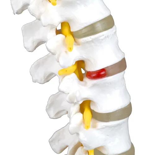Miniatura 5 de Columna vertebral lumbar articulada de grado médico VAV262 Cuenta con 5 lumbares/vértebras con discos intervertebrales, nervios lumbares y médula