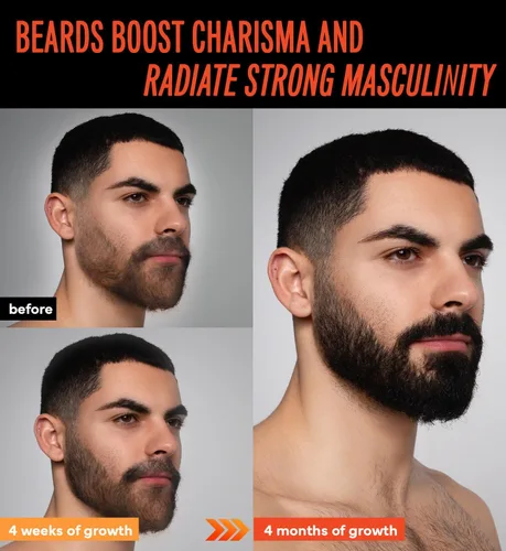 Miniatura 4 de Aceite de crecimiento de barba de minoxidil al 5% para hombres: Minoxidil para hombres Suero de regeneración del pelo de la barba con biotina