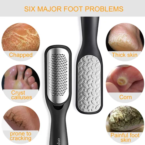 Miniatura 4 de Removedor de callos para pies, raspador de pies colosal y kit profesional de pedicura para eliminar la piel dura para pies húmedos y secos, lima