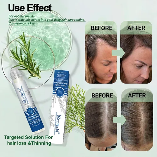 Miniatura 6 de Suero Roll-On para el crecimiento del cabello, 0.8 fl oz, con Polygonum Multiflorum, Platycladus Orientalis, raíz de angélica, aloe y romero
