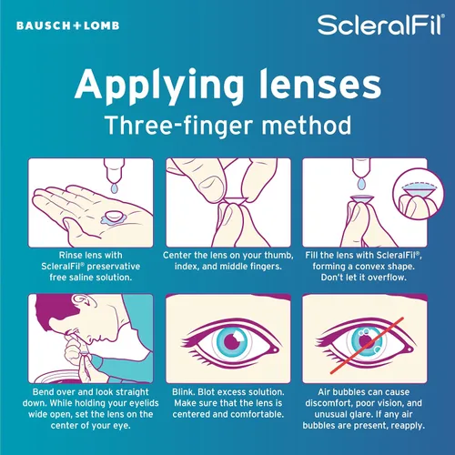Miniatura 5 de ScleralFil Solución salina libre de conservantes para lentes esclerales, solución de enjuague isotónico tamponado e inserción para contactos suaves