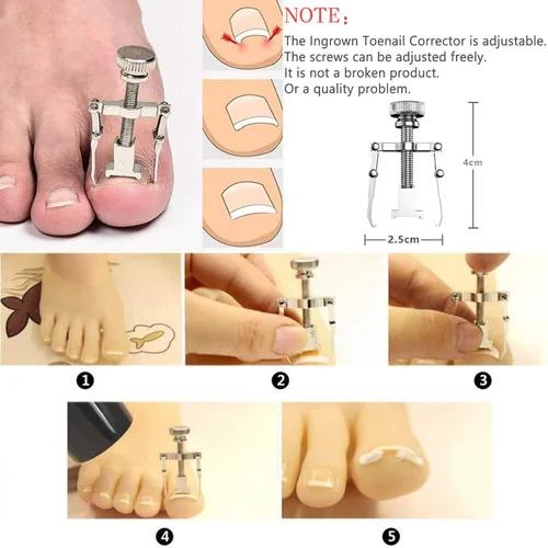 Miniatura 2 de JTIEO Cortaúñas para dedos de los pies, podólogo, cortaúñas para uñas gruesas, kit de uñas de acero inoxidable para uñas encarnadas (plateado)