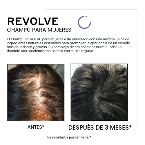 Miniatura 4 de ZENAGEN Revolve Champú Espesante para Mujeres Apoya la Apariencia de Cabello Más Abundante y de Aspecto Más Saludable, Desarrollado para Cabello