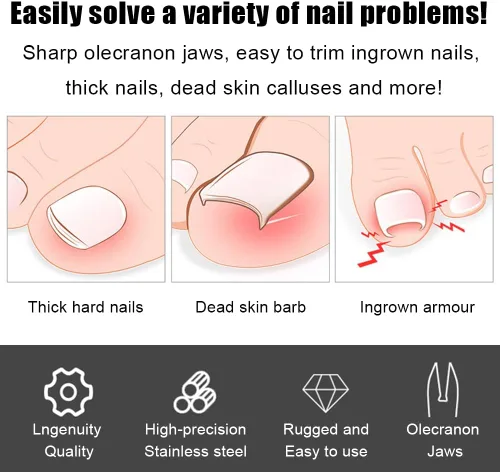 Miniatura 3 de Cortaúñas para uñas gruesas, cortaúñas encarnadas de alta resistencia para eliminación de uñas encarnadas, herramienta de pedicura profesional